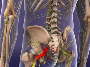 Education about sciatica causes and chiropractic care
