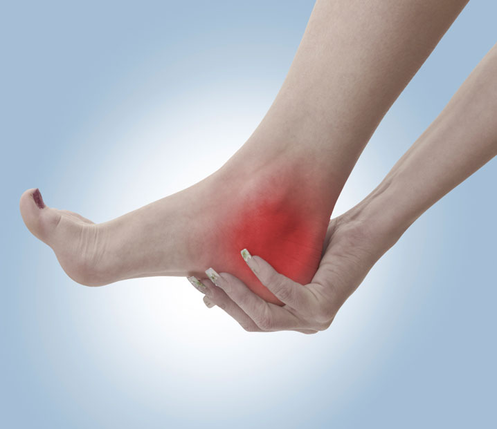 Plantar Fasciitis Chiropractors San Francisco Financial District