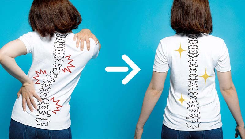 the Ultimate Guide To Good Posture by aSan Francisco Chiropractor at Shapero Chiropractic
