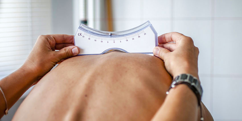 patient needing scoliosis chiropractor in the Financial District, Downtown San Francisco